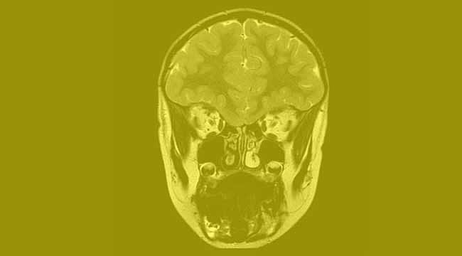 Kallmann Sendromu Vakfı kuruluşuna onay